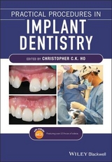 Practical Procedures in Implant Dentistry - 