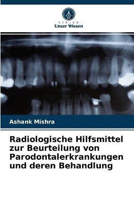 Radiologische Hilfsmittel zur Beurteilung von Parodontalerkrankungen und deren Behandlung