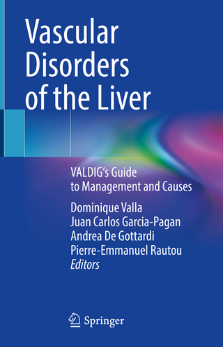 Vascular Disorders of the Liver