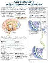 Understanding Major Depressive Disorder - 