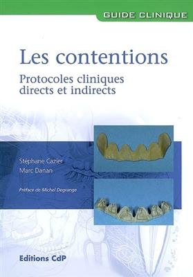 Les contentions : protocoles cliniques directs et indirects - St&eacute;phane Cazier, Marc Danan
