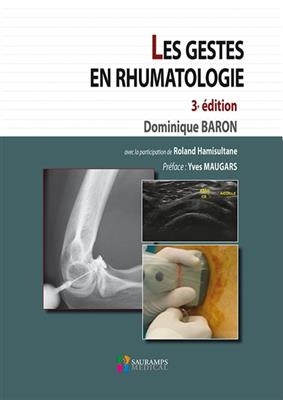 Les gestes en rhumatologie - Dominique Baron