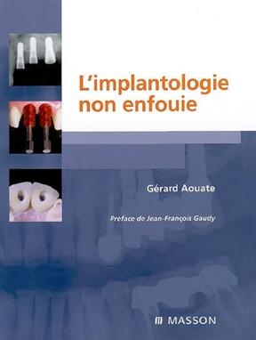 L'implantologie non enfouie