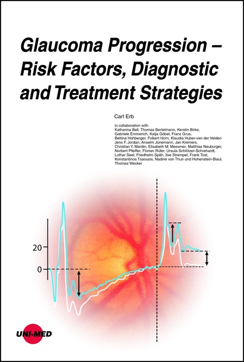 Glaucoma Progression - Risk Factors, Diagnostic and Treatment Strategies - Carl Erb