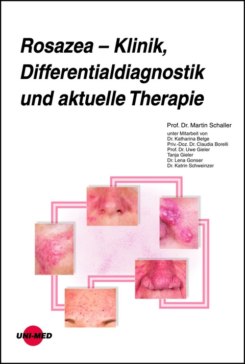 Rosazea &ndash; Klinik, Differentialdiagnostik und aktuelle Therapie - Martin Schaller
