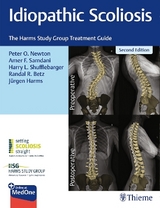 Idiopathic Scoliosis - Newton, Peter; Samdani, Amer; Shufflebarger, Harry; Betz, Randal; Harms, Jurgen