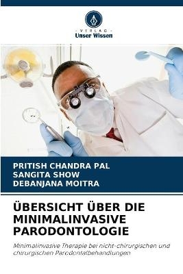 Übersicht Über Die Minimalinvasive Parodontologie