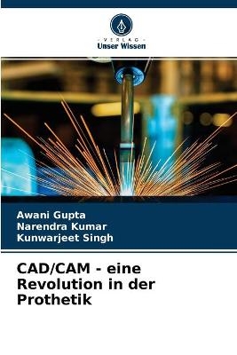 CAD/CAM - eine Revolution in der Prothetik