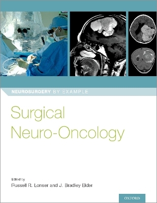 Surgical Neuro-Oncology - 
