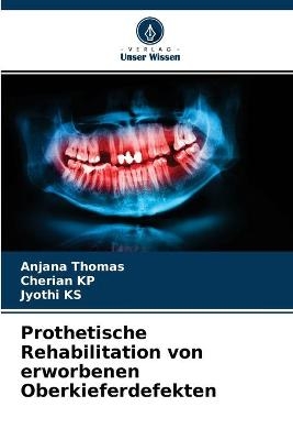 Prothetische Rehabilitation von erworbenen Oberkieferdefekten
