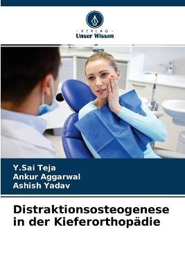 Distraktionsosteogenese in der Kieferorthop&auml;die - Y Sai Teja, Ankur Aggarwal, Ashish Yadav