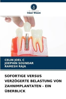 Sofortige Versus Verzögerte Belastung Von Zahnimplantaten - Ein Überblick