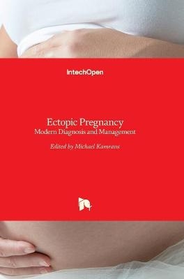 Ectopic Pregnancy - 