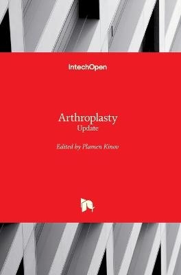 Arthroplasty - 