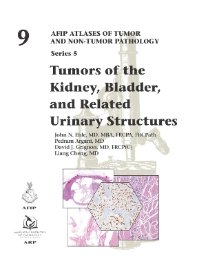 Tumors of the Kidney, Bladder, and Related Urinary Structures - John Eble, Pedram Argani, Liang Cheng, David J. Grignon