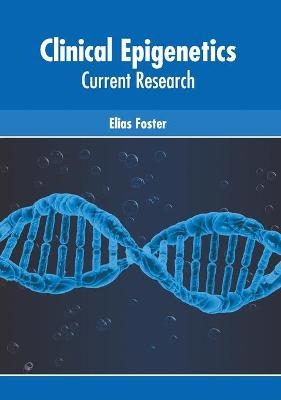 Clinical Epigenetics: Current Research