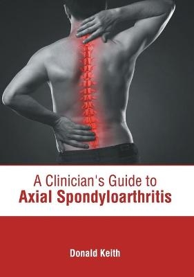 A Clinician's Guide to Axial Spondyloarthritis