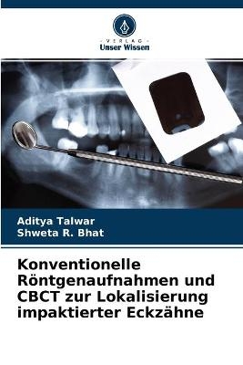 Konventionelle Röntgenaufnahmen und CBCT zur Lokalisierung impaktierter Eckzähne