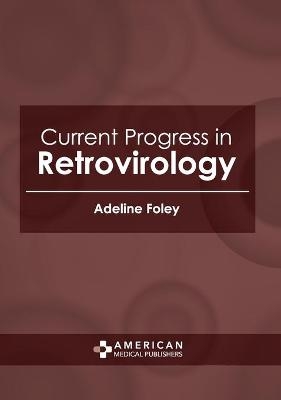 Current Progress in Retrovirology