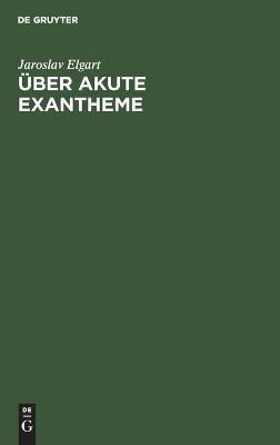 &Uuml;ber akute Exantheme - Jaroslav Elgart