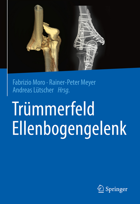 Tr&uuml;mmerfeld Ellenbogengelenk - 