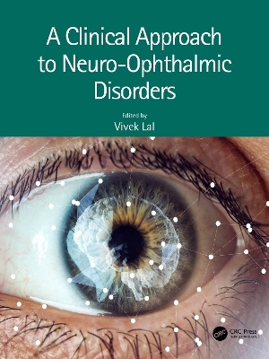 A Clinical Approach to Neuro-Ophthalmic Disorders