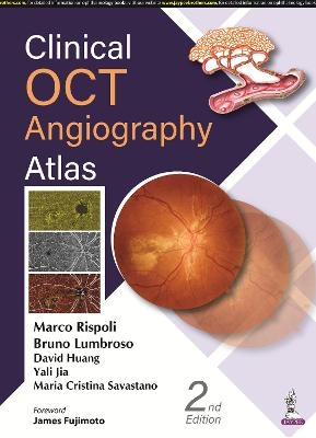 Clinical OCT Angiography Atlas - Marco Rispoli, Bruno Lumbroso, David Huang, Yali Jia, Maria Cristina Savastano