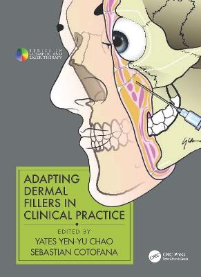 Adapting Dermal Fillers in Clinical Practice - 