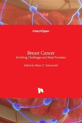 Breast Cancer - 