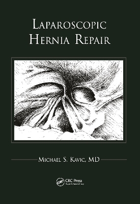 Laparoscopic Hernia Repair - Michael S Kavic