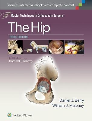 Master Techniques in Orthopaedic Surgery: The Hip - 