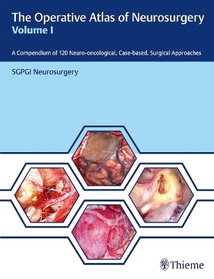 The Operative Atlas of Neurosurgery