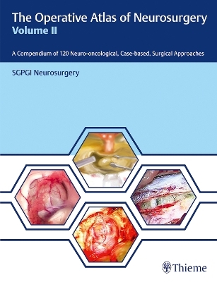 The Operative Atlas of Neurosurgery, Vol II