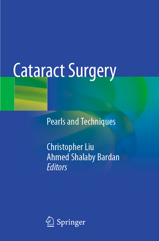Cataract Surgery