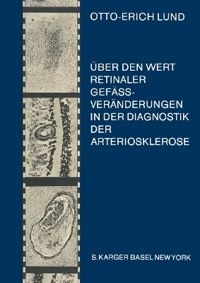 Über den Wert retinaler Gefässveränderungen in der Diagnostik der Arteriosklerose (insbesondere der Hirnarteriosklerose)
