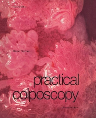 Practical Colposcopy