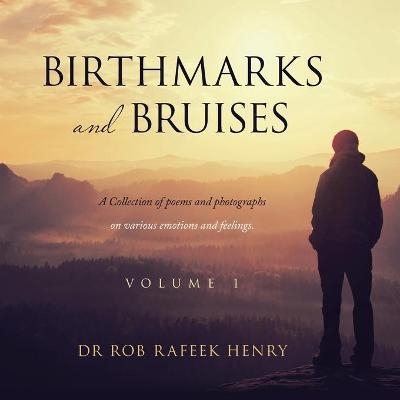 Birthmarks and Bruises - Dr Rob Rafeek Henry