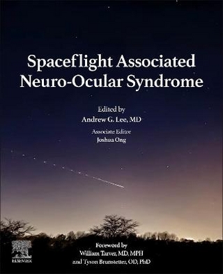 Spaceflight Associated Neuro-Ocular Syndrome