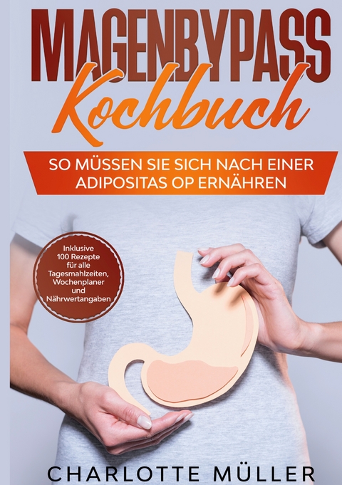 Magenbypass Kochbuch - Charlotte M&uuml;ller