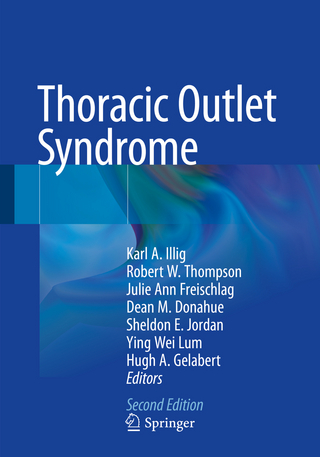 Thoracic Outlet Syndrome