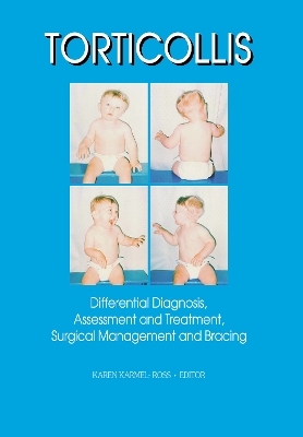 Torticollis - Karen Karmel-Ross