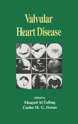 Valvular Heart Disease - 