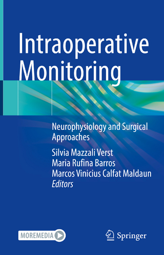 Intraoperative Monitoring