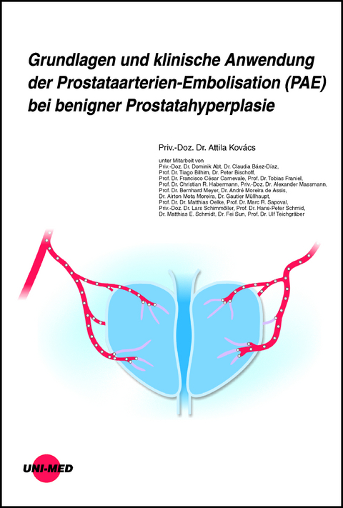 Grundlagen und klinische Anwendung der Prostataarterien-Embolisation (PAE) bei benigner Prostatahyperplasie - Attila Kov&aacute;cs