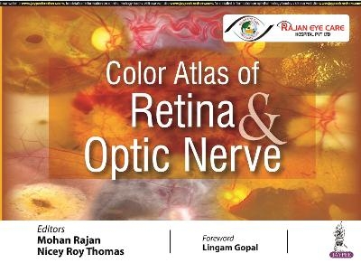 Color Atlas of Retina & Optic Nerve - Mohan Rajan, Nicey Roy Thomas