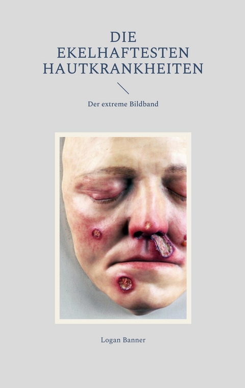 Die ekelhaftesten Hautkrankheiten - Logan Banner