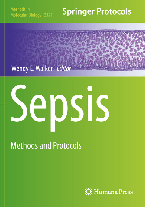 Sepsis - 