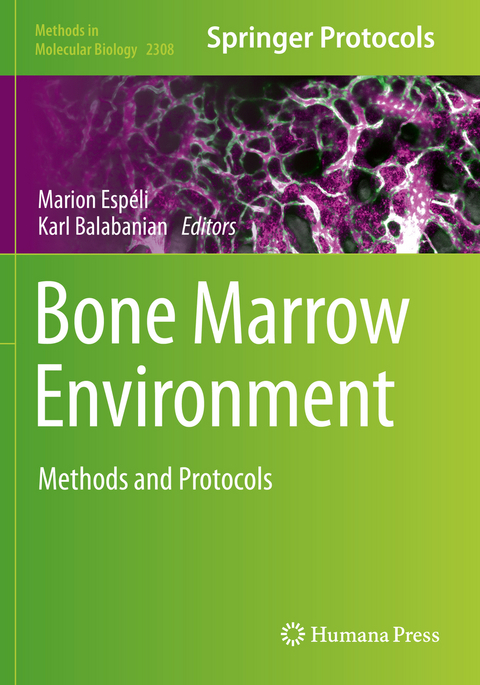 Bone Marrow Environment - 