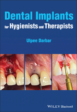 Dental Implants for Hygienists and Therapists - Ulpee Darbar