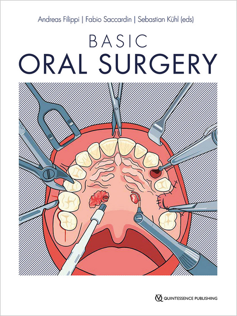 Basic Oral Surgery - 